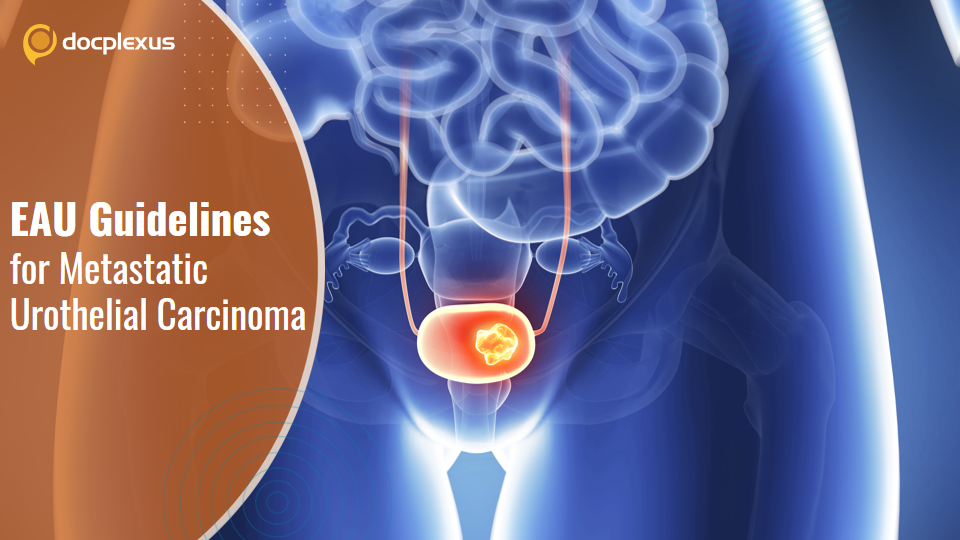 Metastatic Urothelial Carcinoma Management: European Association of Urology Guidelines (2021)