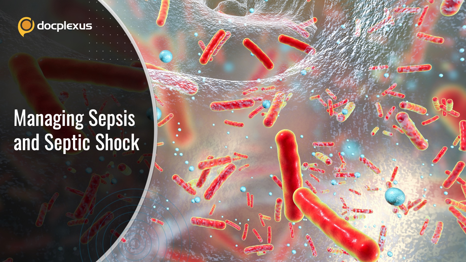 Sepsis and Septic Shock: Best Practice Management and Strong Recommendations  Part 1
