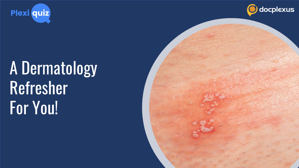Ace This Quiz on Vesiculobullous Lesions