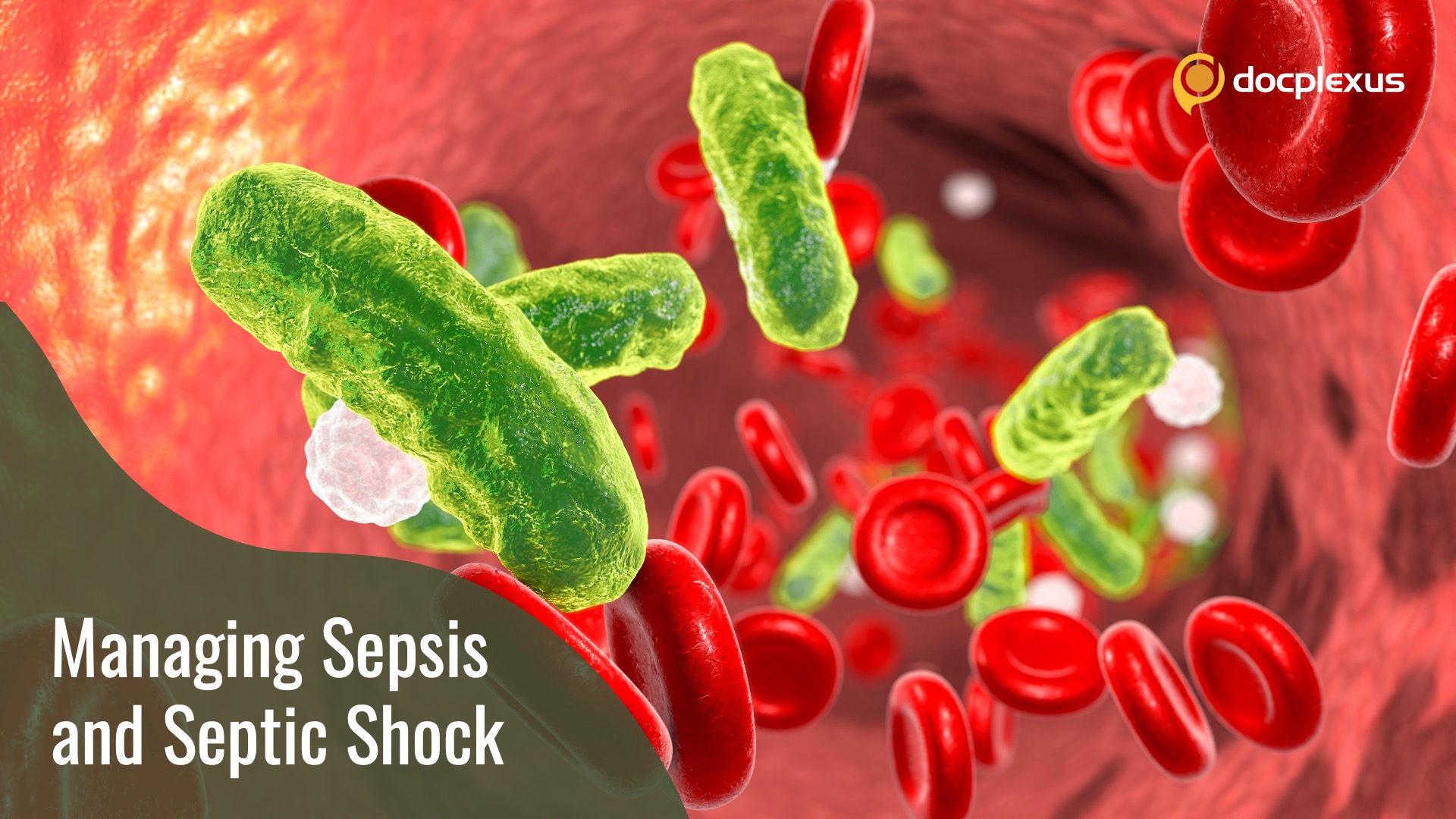 Sepsis and Septic Shock: Weak Recommendations, Insufficient Evidences and No Recommendations Part 2