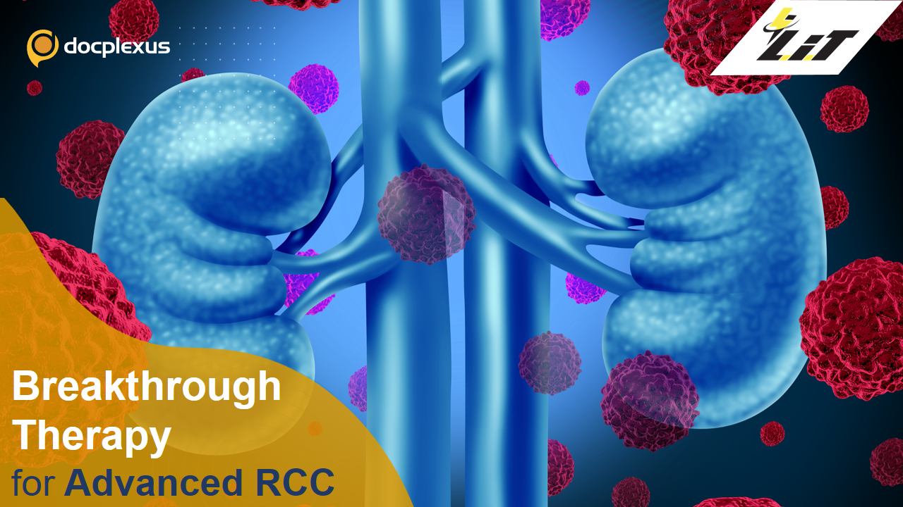 FDA Approves First-line Combination Drugs for RCC