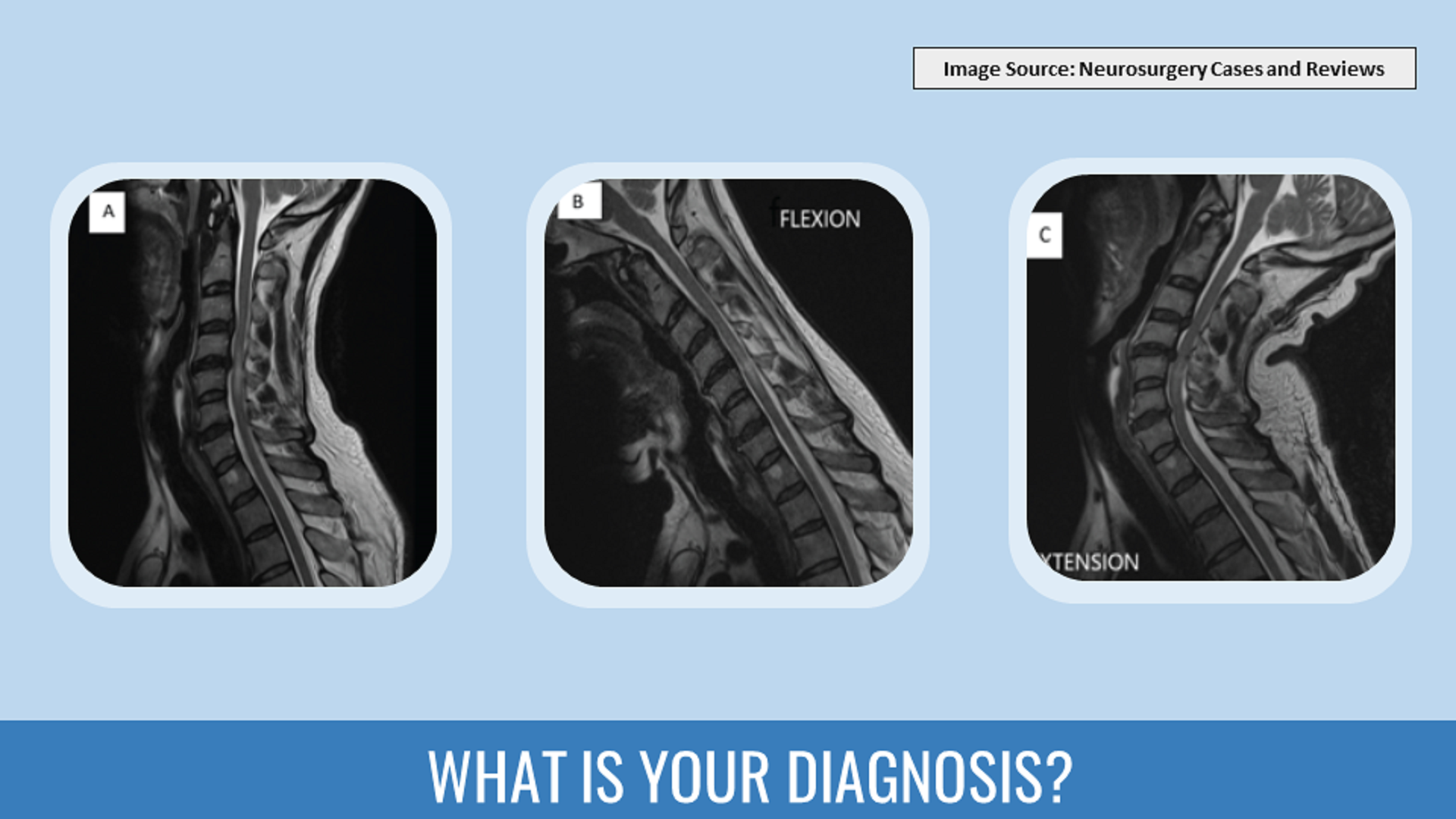 Identify the Underlying Spinal Pathology