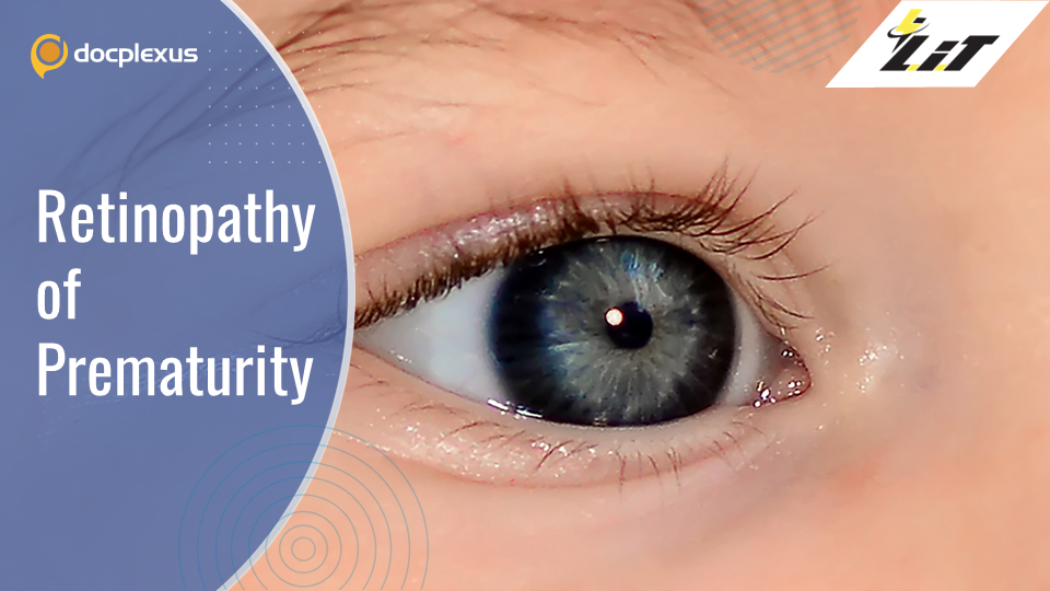 Retinopathy of Prematurity – An Emerging Epidemic in India?