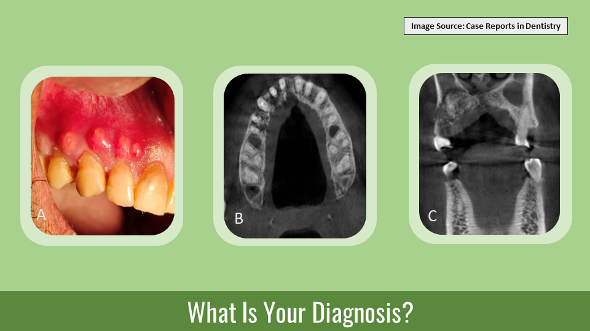 Identify the Underlying Dental Pathology