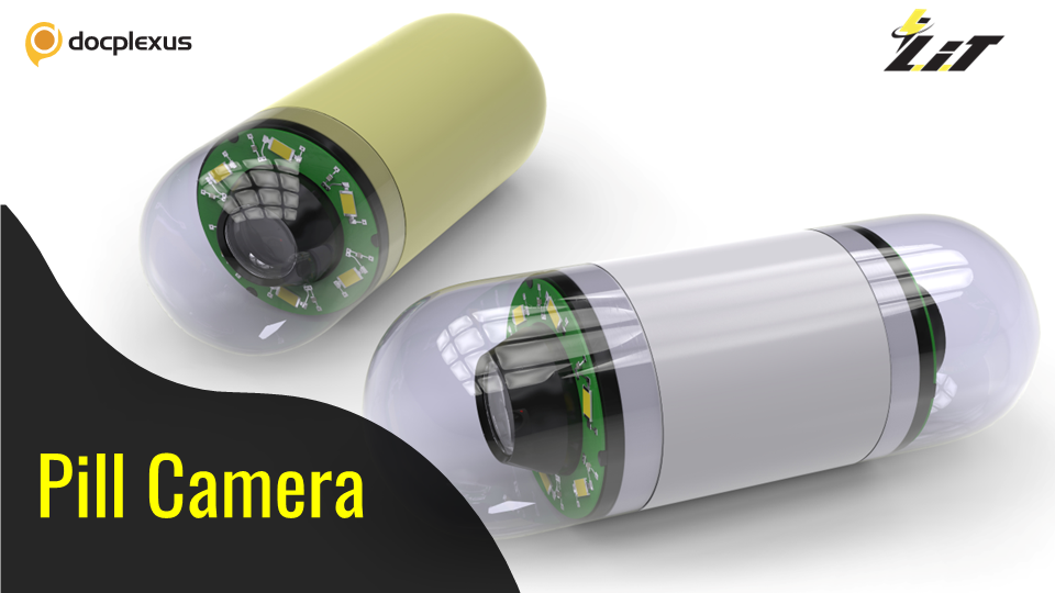 Capsule Endoscopy – A Promising Gastrointestinal Procedure