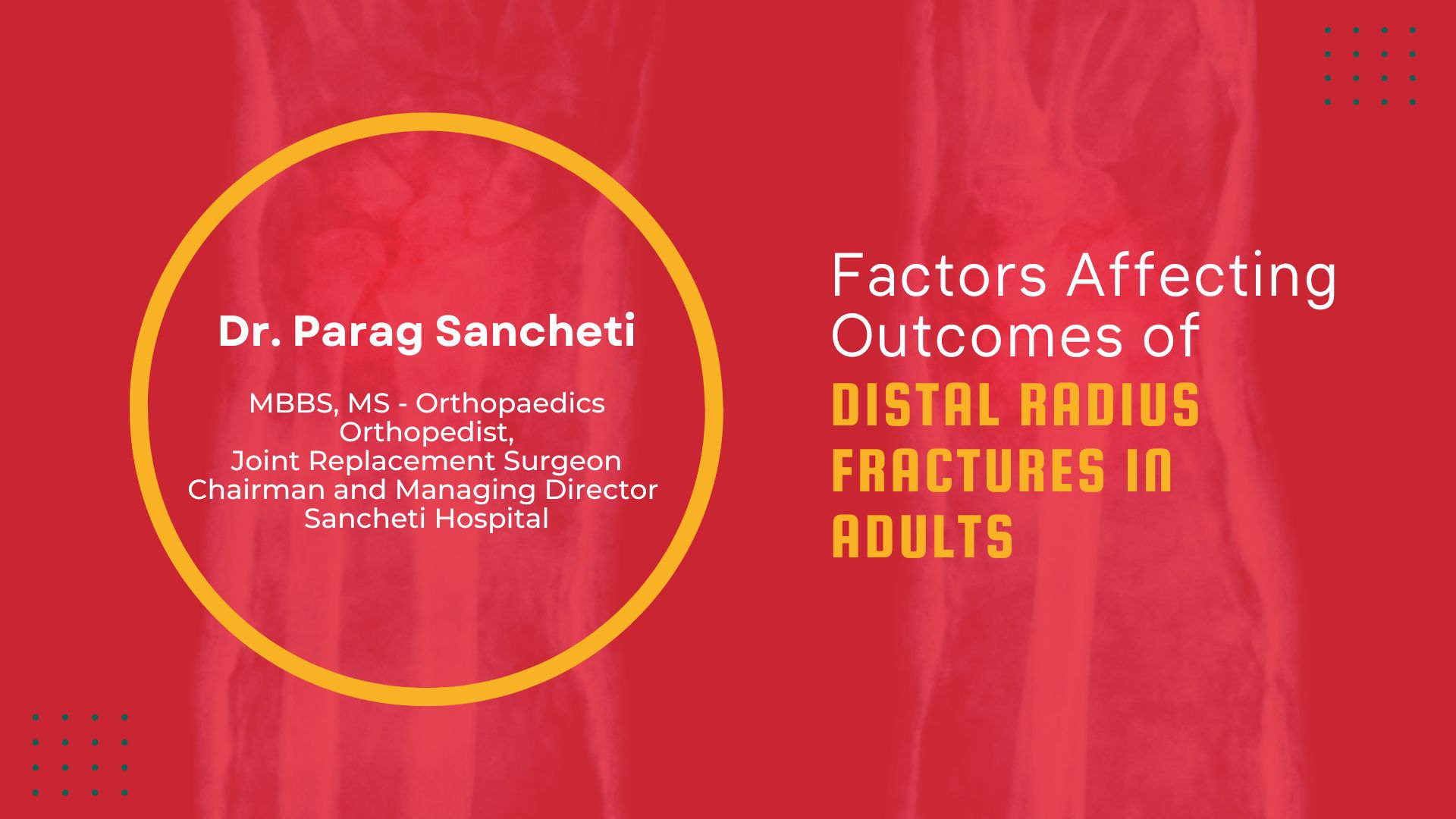 Factors Affecting Outcomes of Distal Radius Fractures in Adults