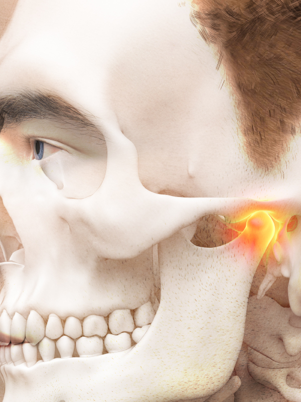 Bifid Mandibular Condyles and TMJ Disorders