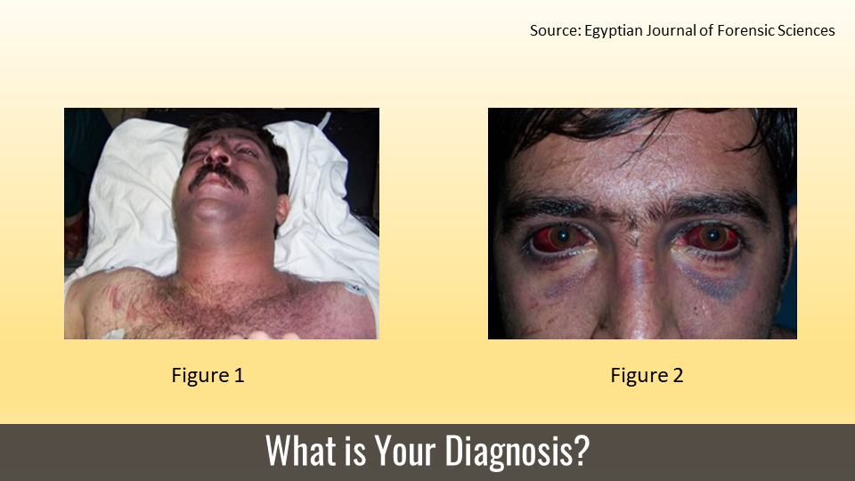 Can you Diagnose This Post-traumatic Condition?