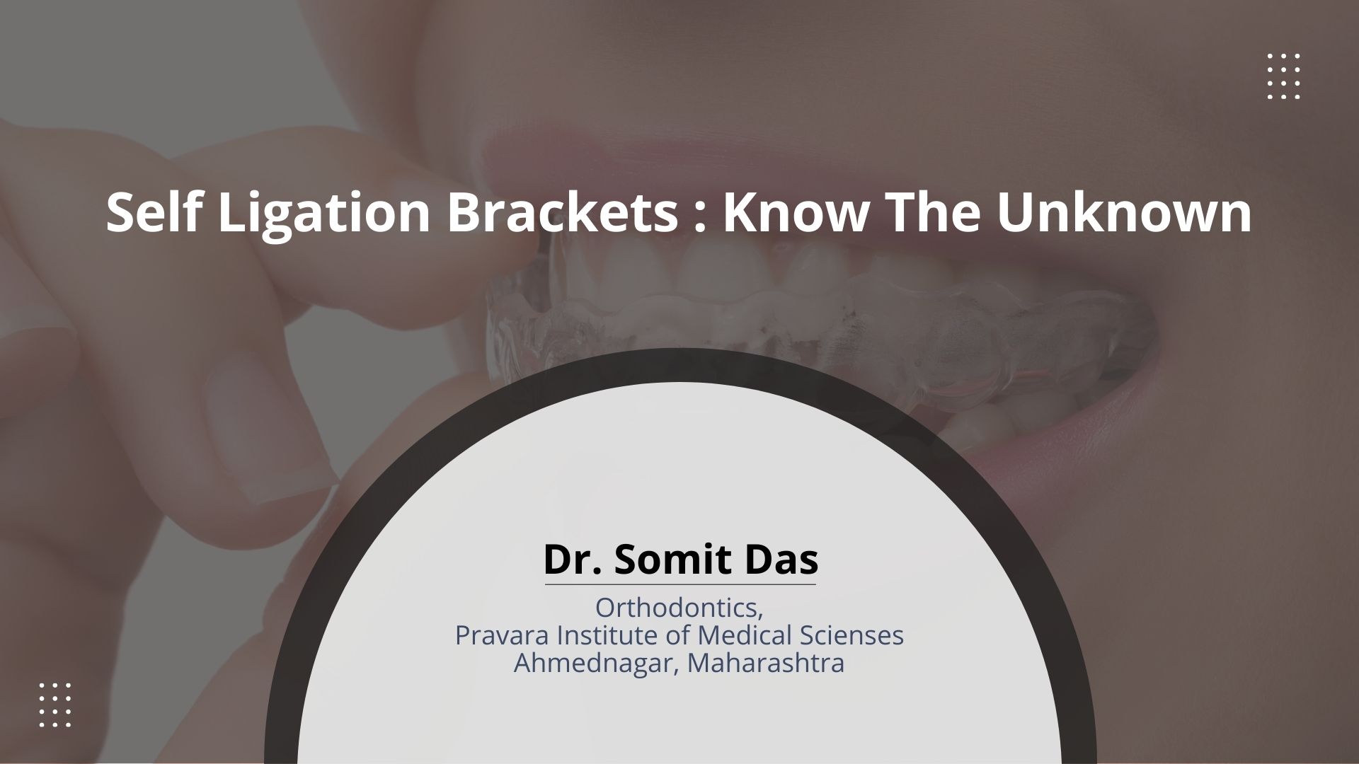 Self Ligation Brackets: Know The Unknown