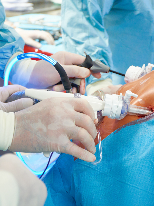 Overview of Obesity and Bariatric Surgery