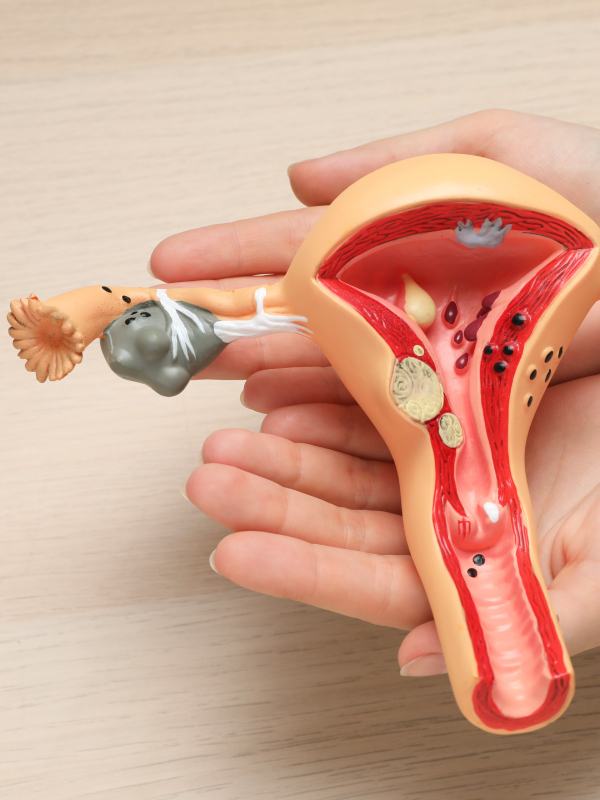Surgical Treatment of Cervical Cancer