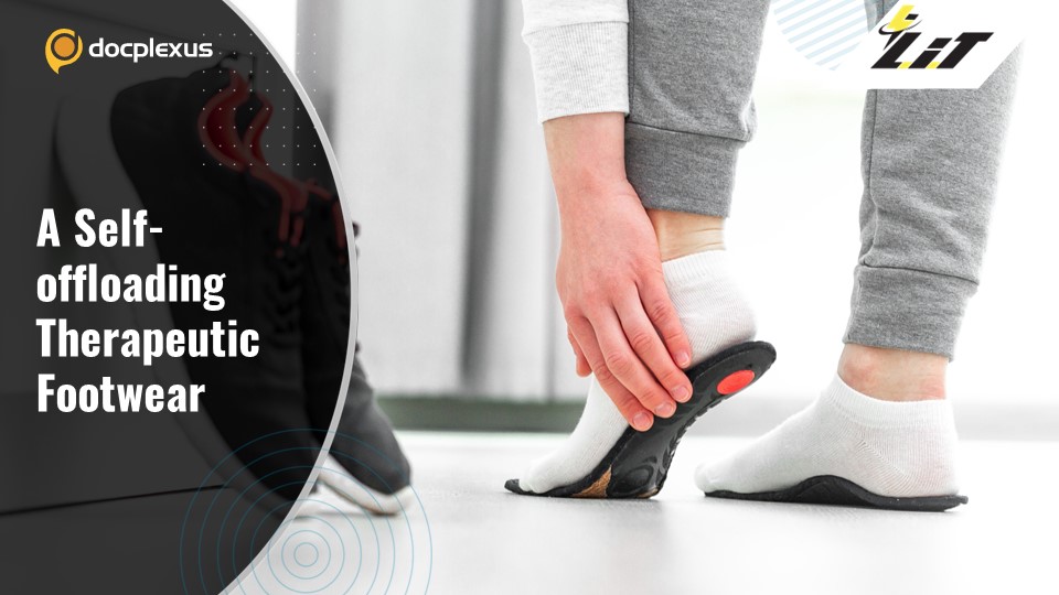 Therapeutic Footwear Using Snap-through Arches