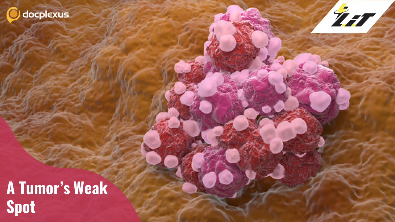 Why Are Certain Tumors Multidrug Resistant?