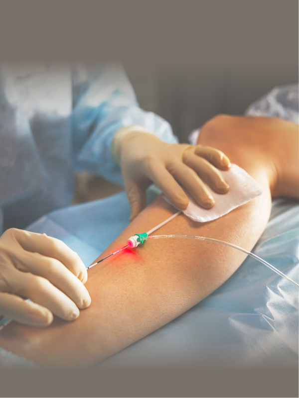 Venous Aneurysms: Do They Differ?
