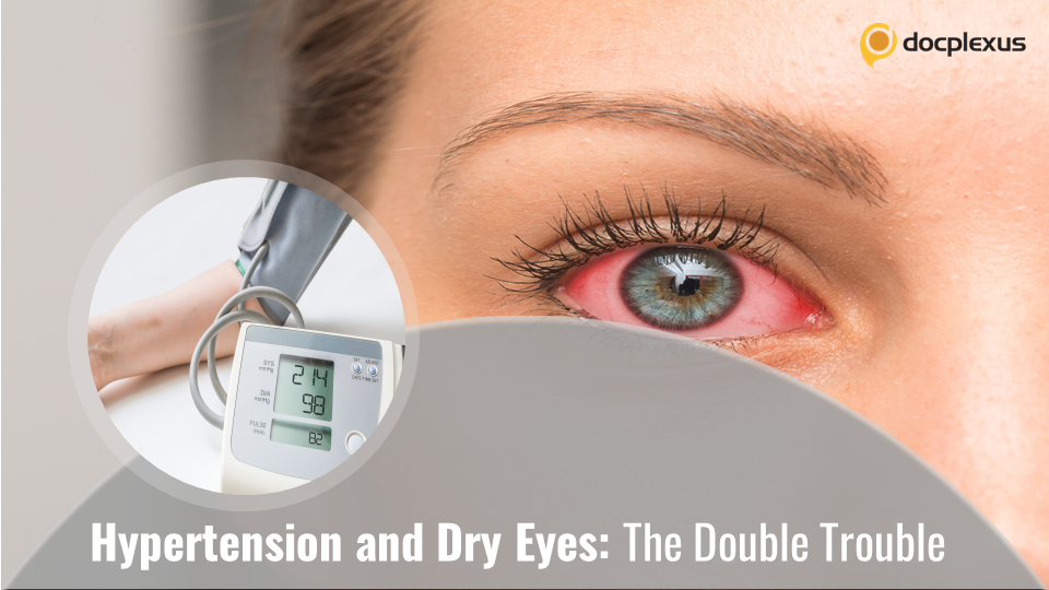 Dry Eye in Hypertensive Patients