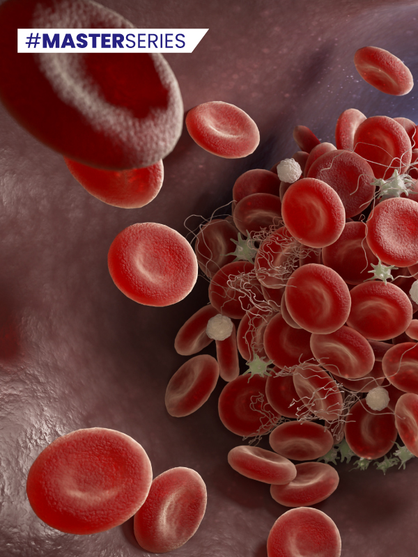 Prevention and Treatment of Post-thrombotic Syndrome
