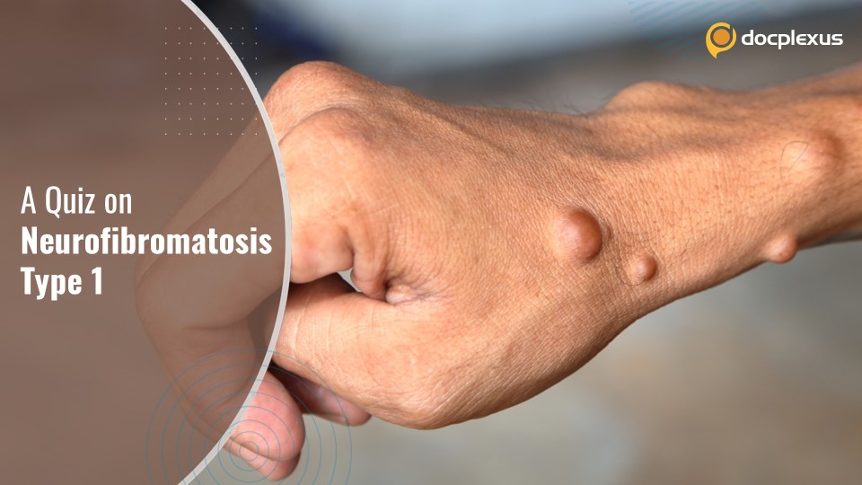 Neurofibromatosis Type 1: Cutaneous Manifestations