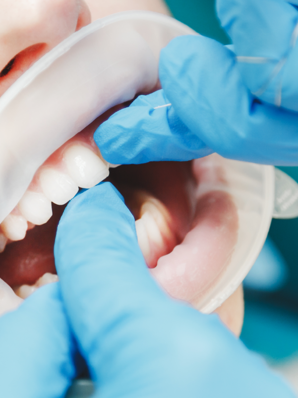 "Test driving smiles" Bridging the Gap Between Expectations and Reality!