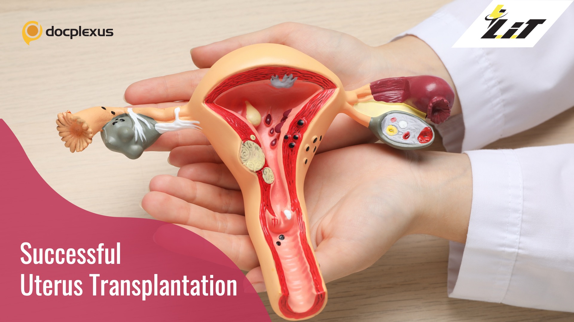 Uterus Transplantation: A Safe and Efficient Infertility Treatment Option