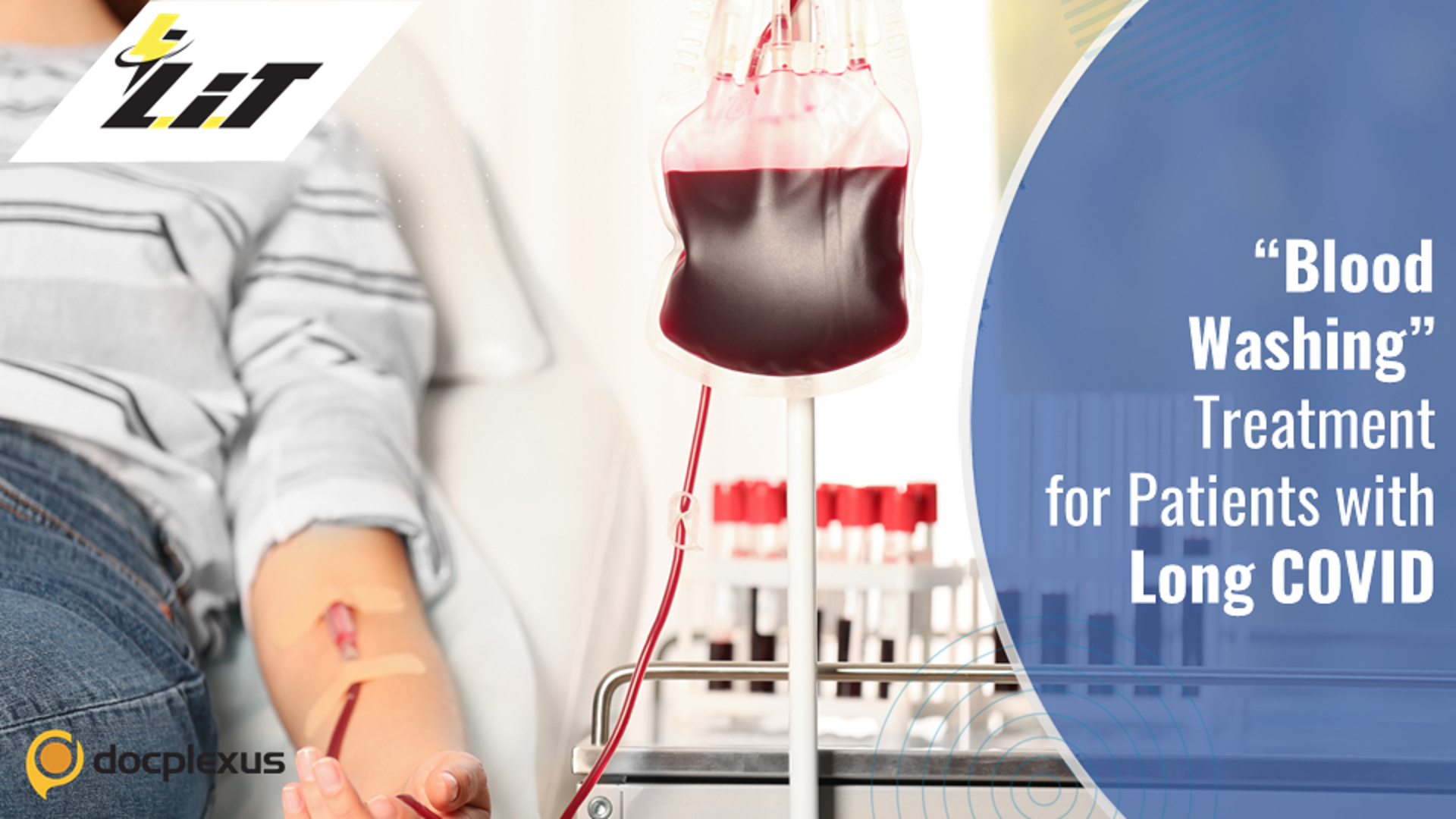 “Blood Washing” Treatment for Patients with Long COVID