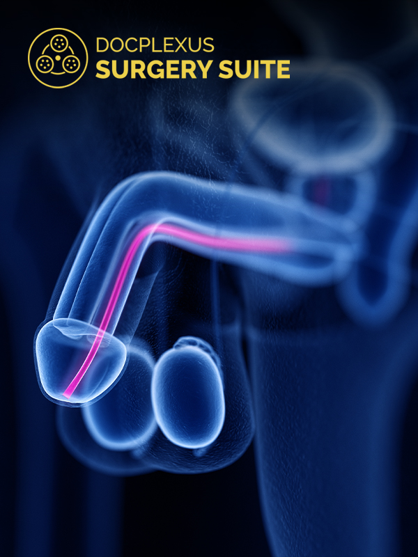 Hypospadias: Redo Surgery for failed Hypospadias
