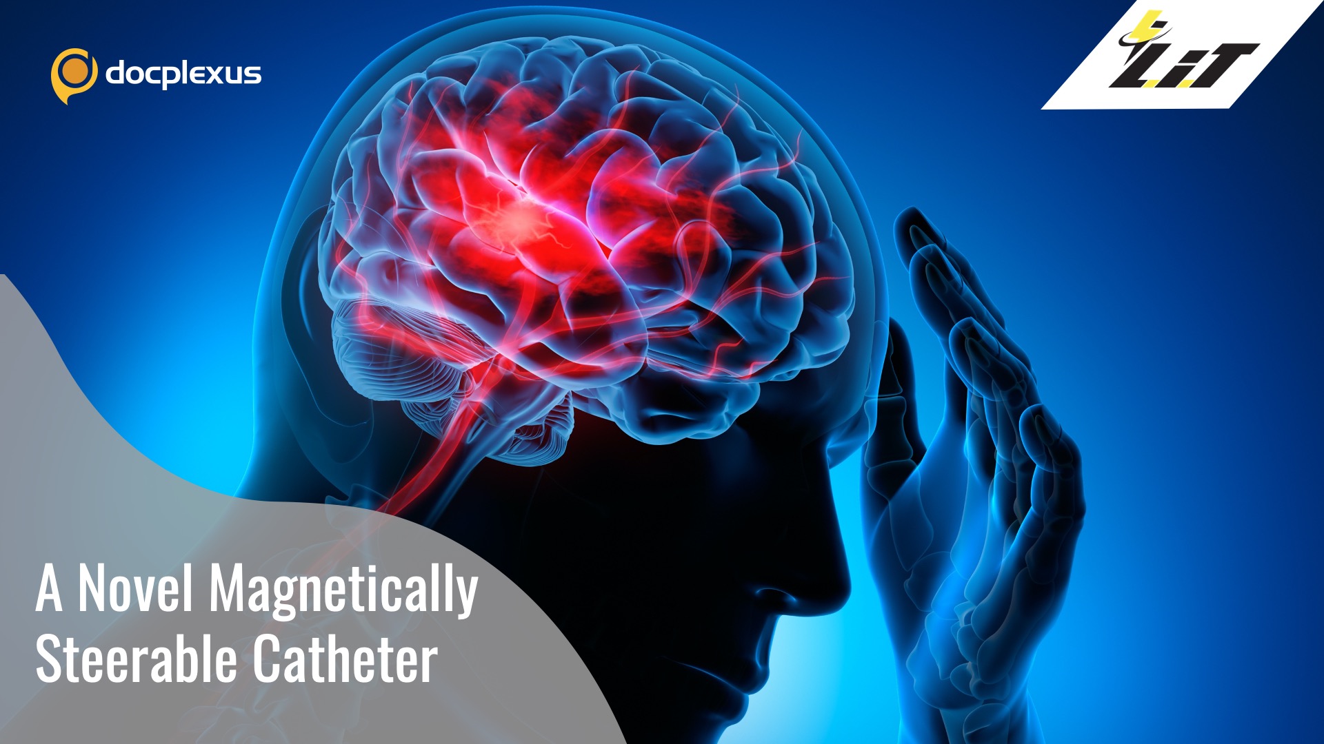 An Innovative Magnetic Catheter to Treat Stroke