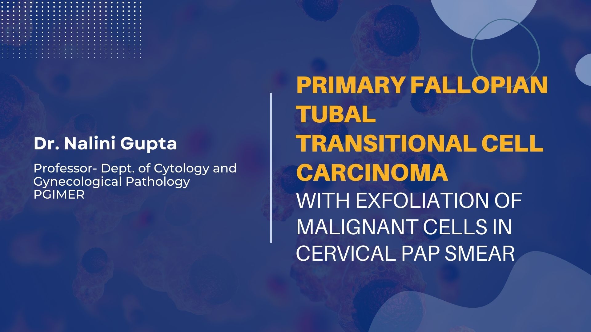 Primary Fallopian Tubal Transitional Cell Carcinoma with Exfoliation of Malignant Cells in Cervical Pap Smear