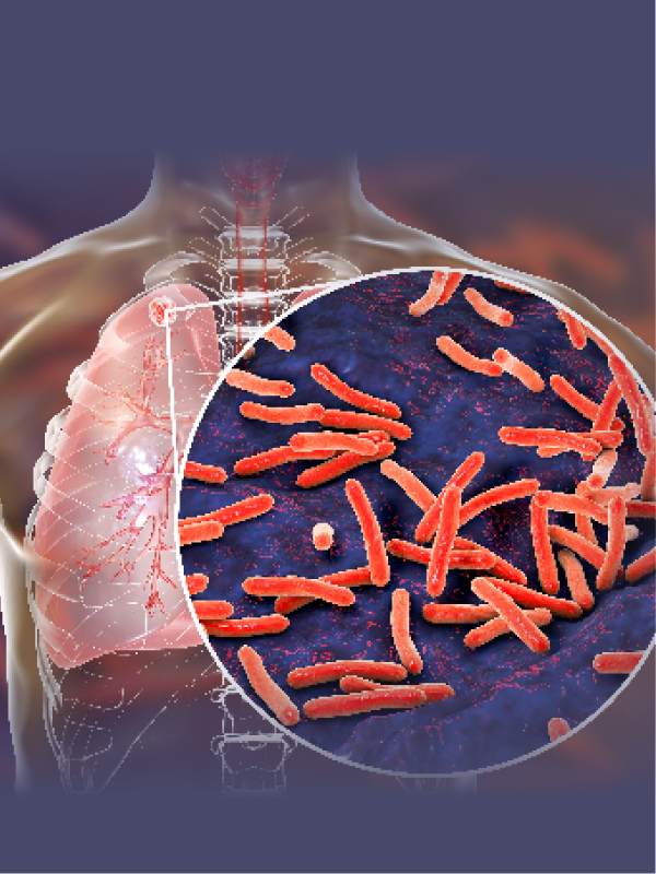 Journey Towards Tuberculosis Elimination in India