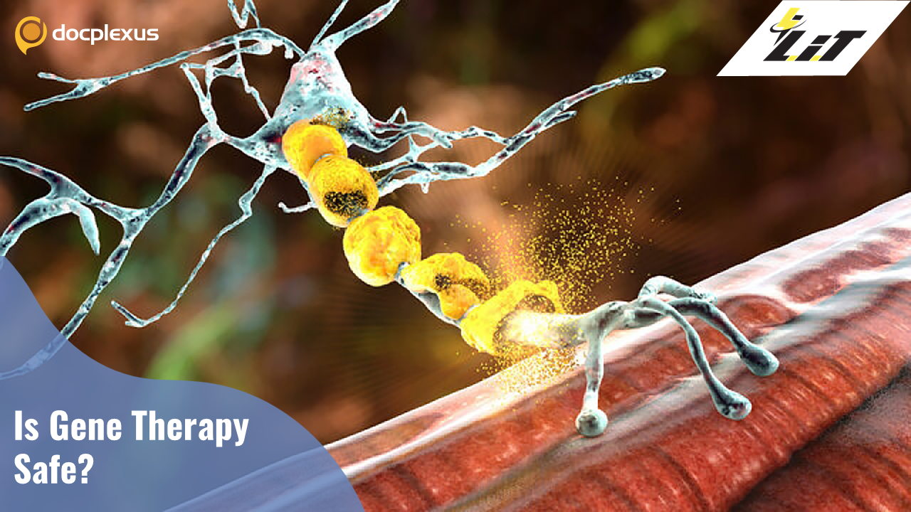 Is Gene Therapy Safe for Spinal Muscular Atrophy Patients?