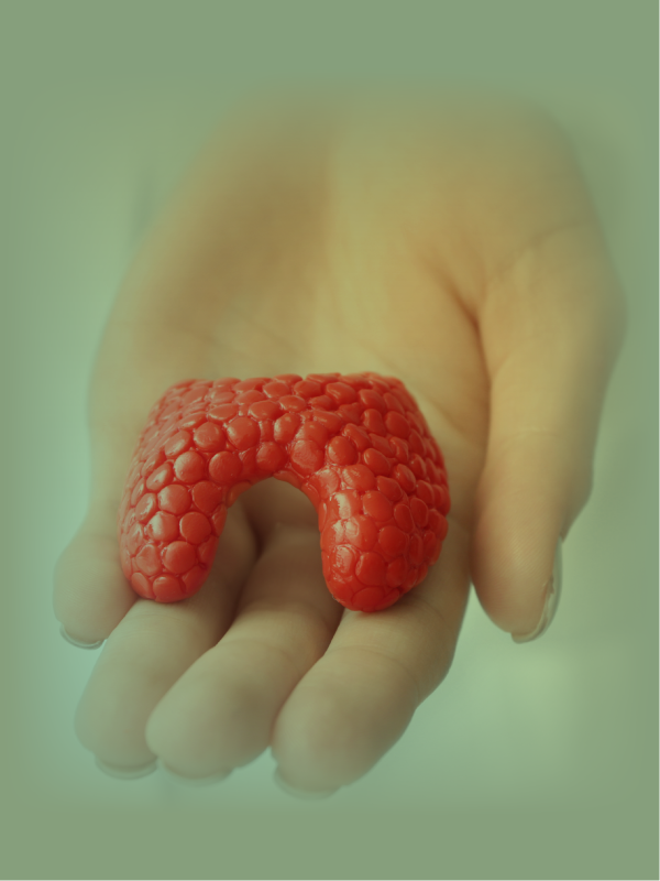 Endocrine Disorders and Their Management