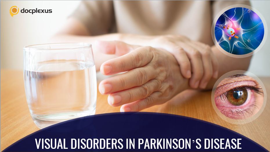 Parkinson’s Disease and Visual Disorders