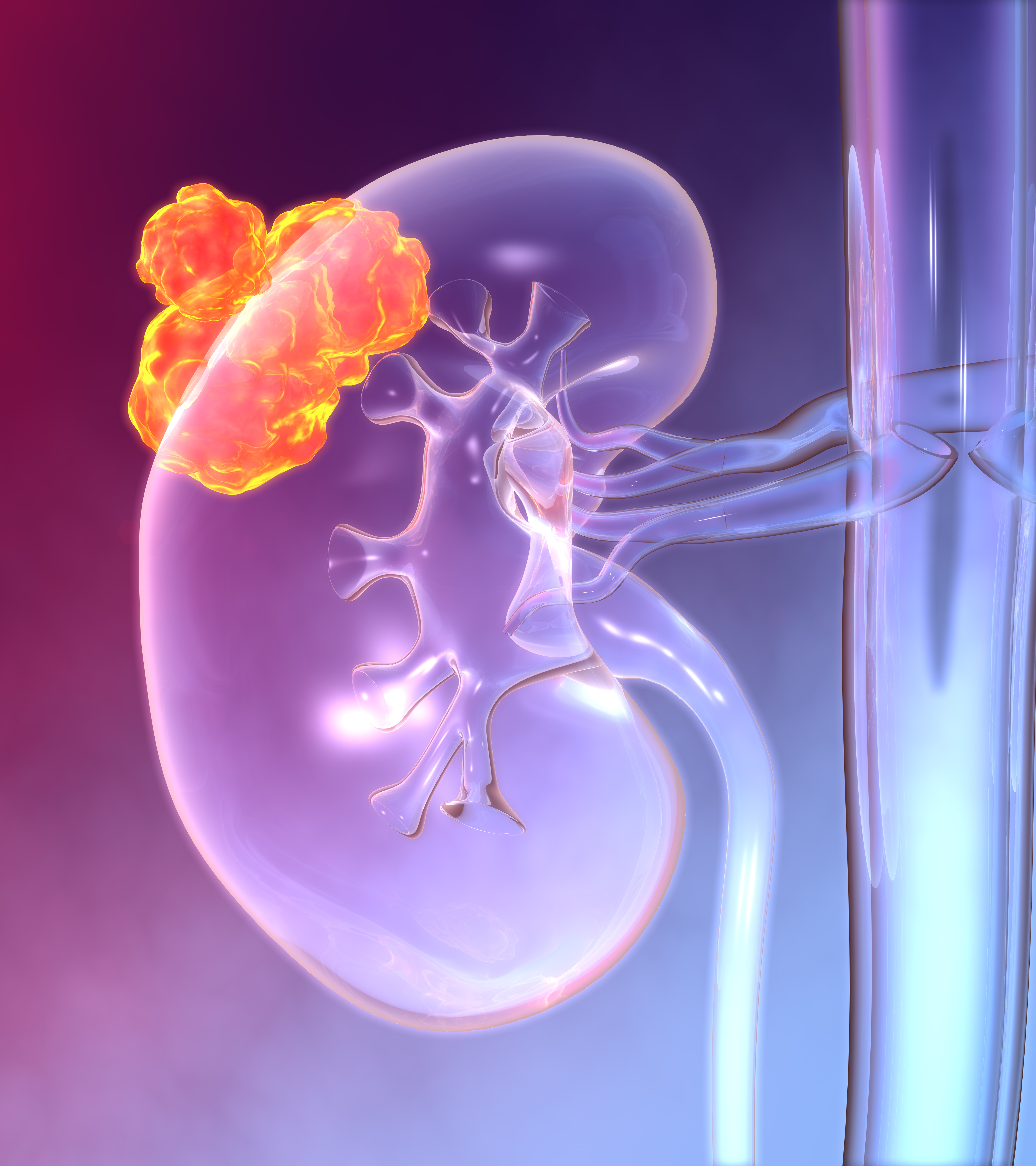Systemic Therapy: Selecting First-line Therapy and Later-line Therapy