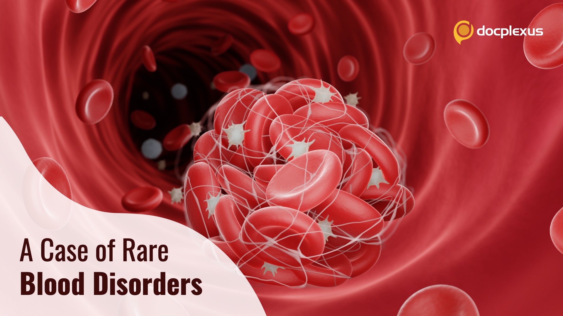 A Rare Occurrence of Two Blood Disorders