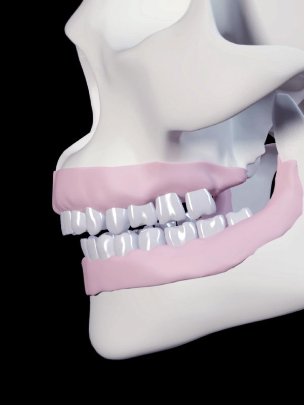 Role of Occlusion and TMJ in Achieving Durable Restoration