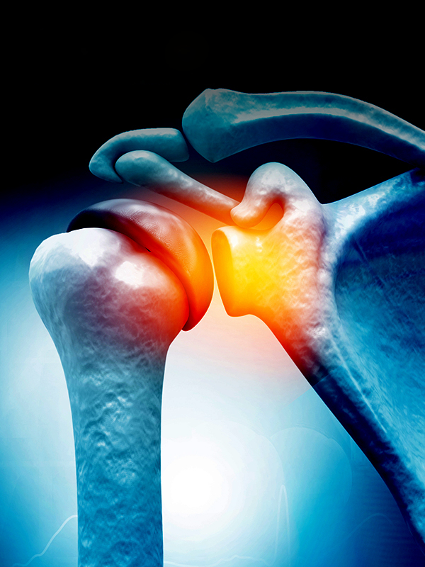 Shoulder Arthroscopy