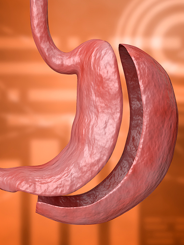 The JBS Show: Bariatric Surgery After COVID and Gastric Bypass for Asian Indians