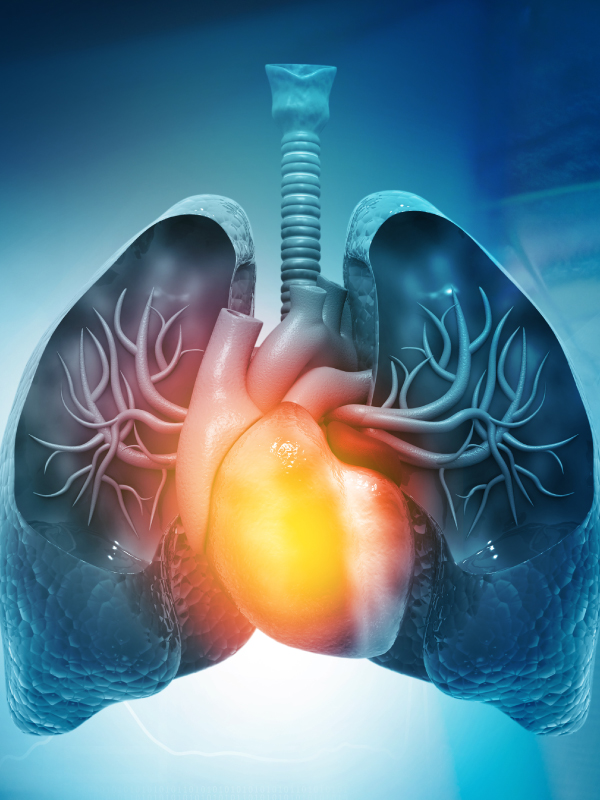 Transplant and Pulmonary Hypertension