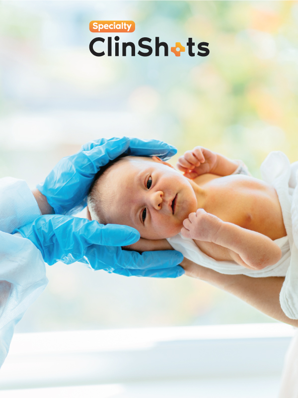 Neonatal Seizures