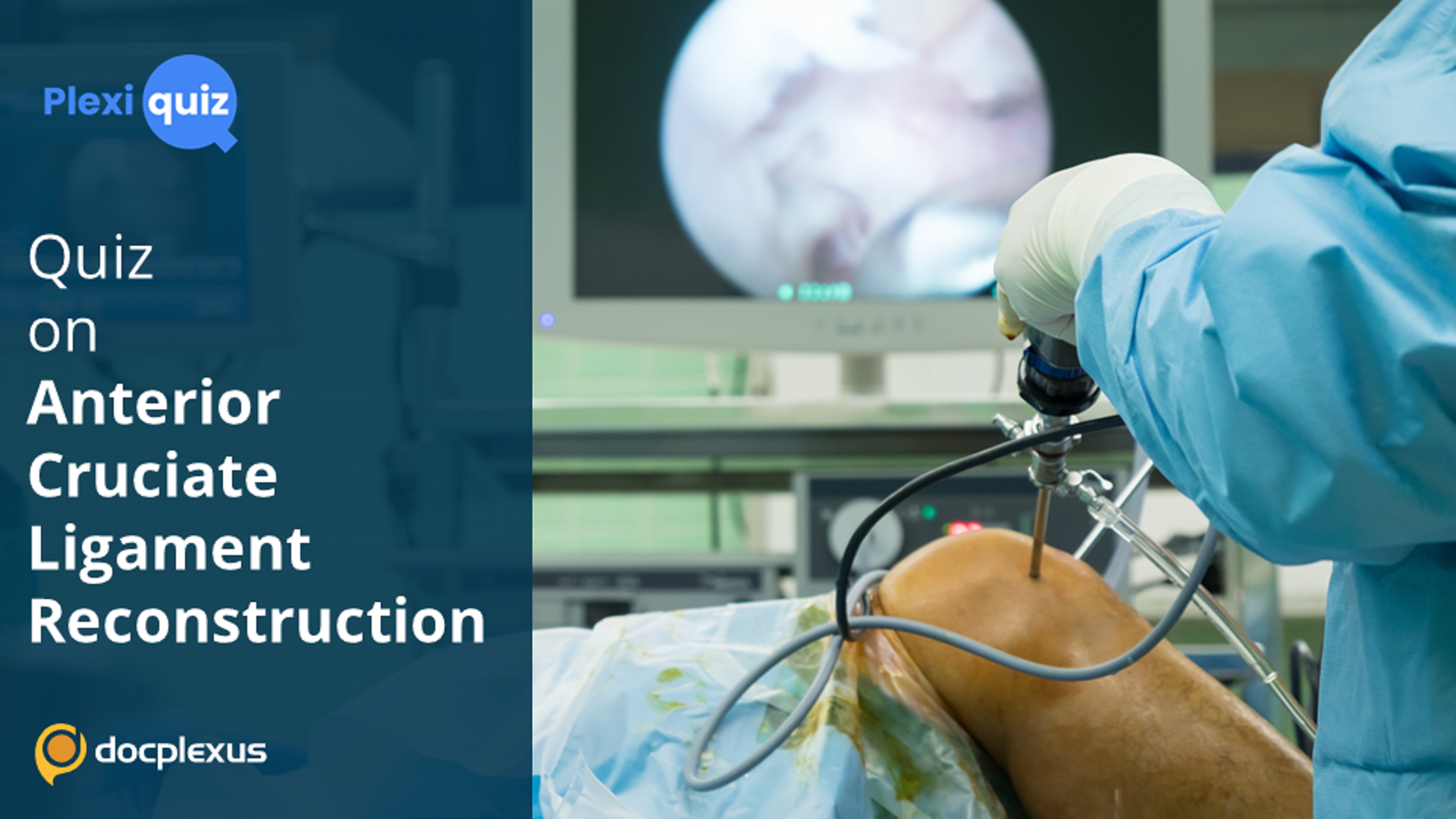 Ace This Quiz on Anterior Cruciate Ligament Reconstruction