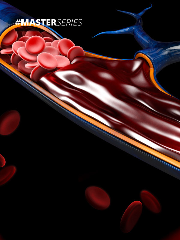 Treatment of Deep Venous Insufficiency with Prosthetic Vein Valve