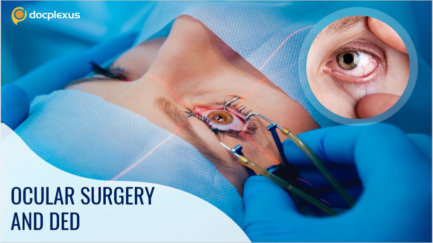 Managing DED with Ocular Surgeries
