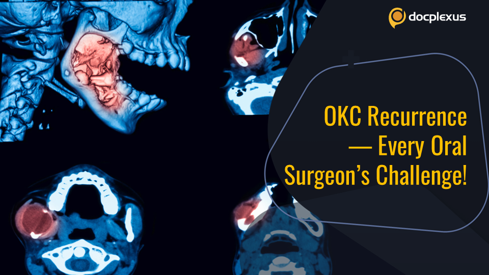 Odontogenic Keratocyst and Its Recurrence — Treatment Algorithm