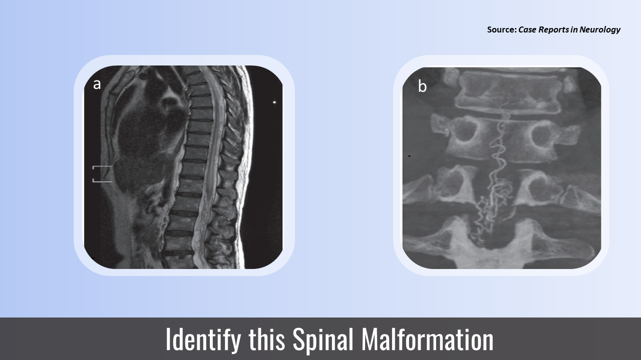 Can you Diagnose this Case of Progressive Muscle Weakness?