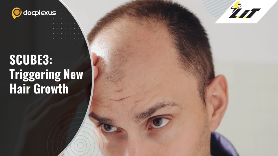 Potential Androgenetic Alopecia Therapy