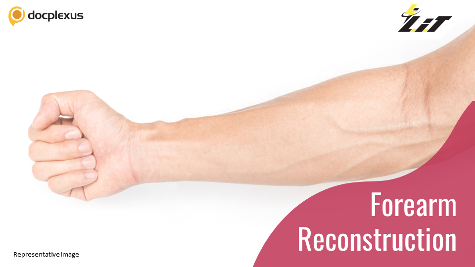 India’s First Successful Forearm Reconstruction Surgery