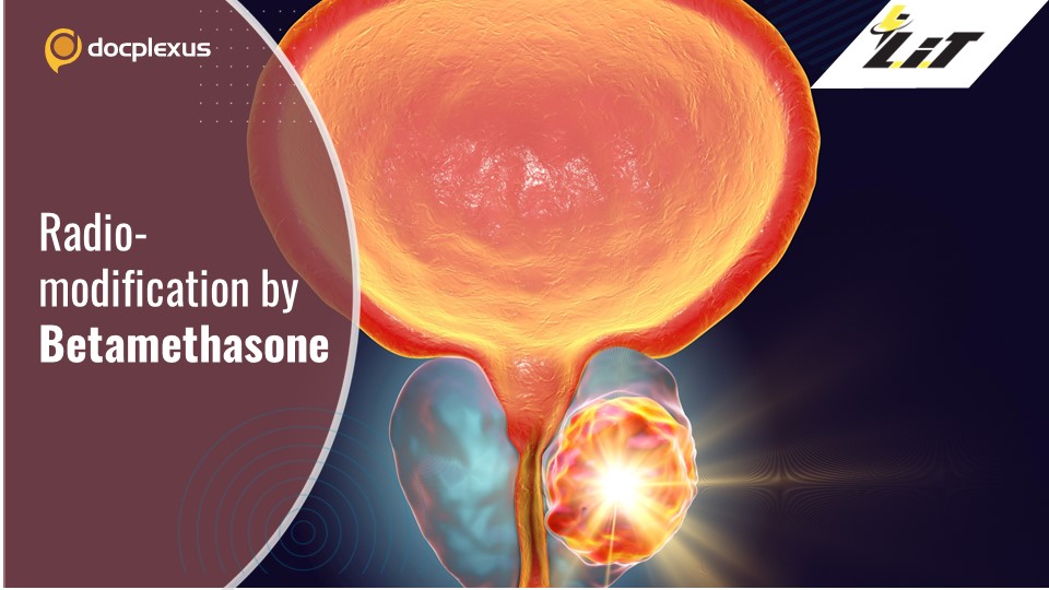Betamethasone Enhances Radiotherapy Outcome in Prostate Cancer Patients