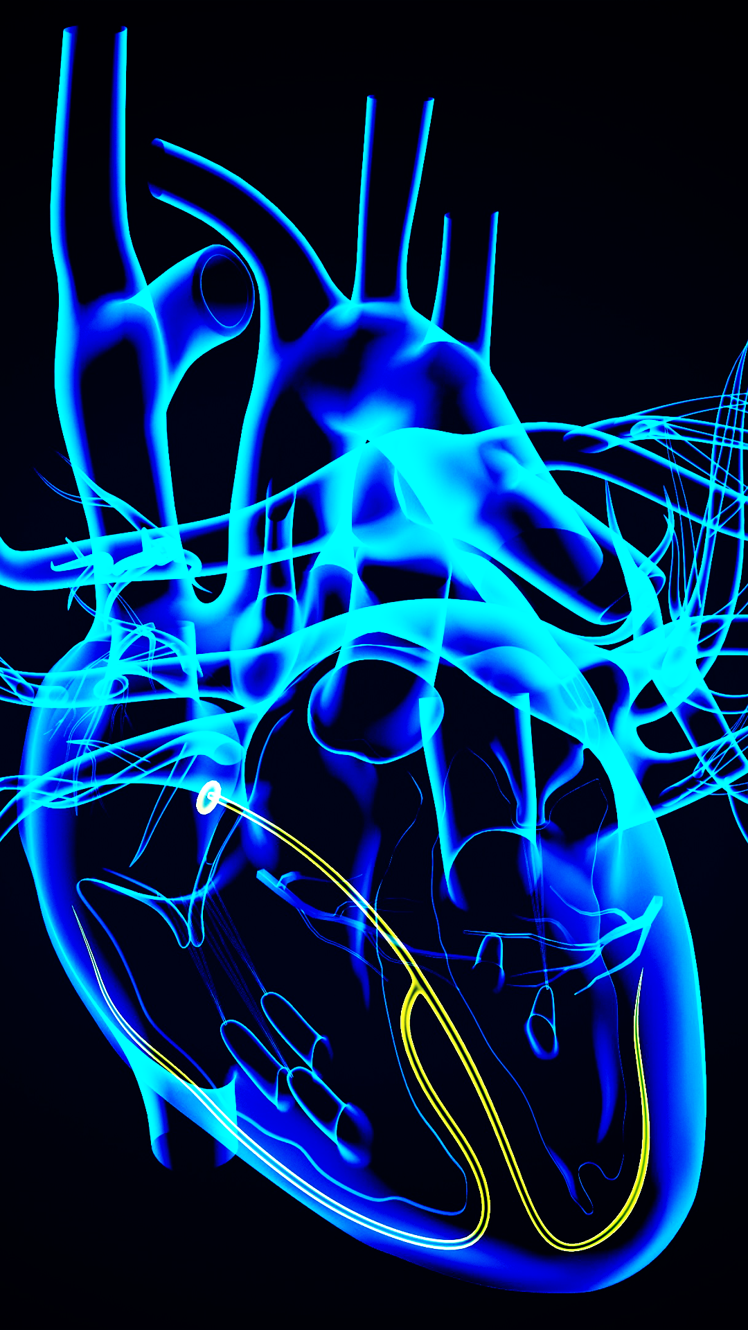 Surgical Management Options for Advanced Heart Failure