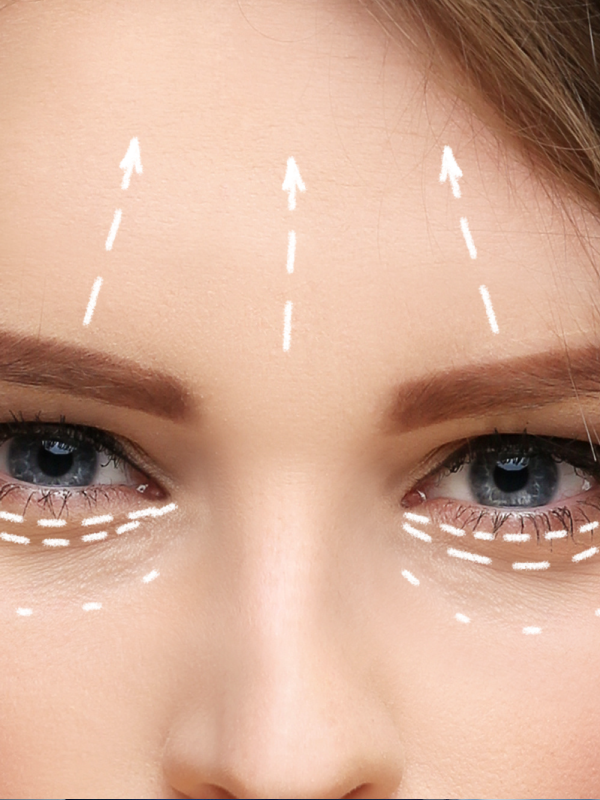 Thomas Lift TM- Bespoke Non Surgical Facial Rejuvenation