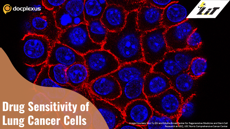 Cancer-associated Fibroblasts Induce Drug Sensitivity
