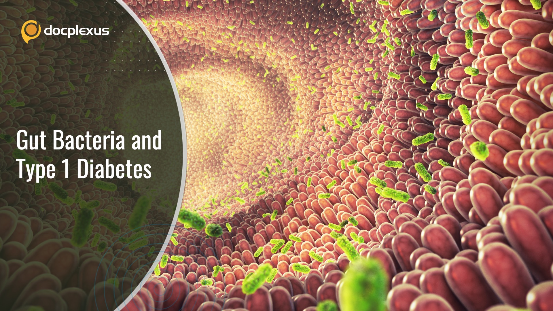 Identify the Gut Bacterium Involved in Type 1 Diabetes Pathogenesis